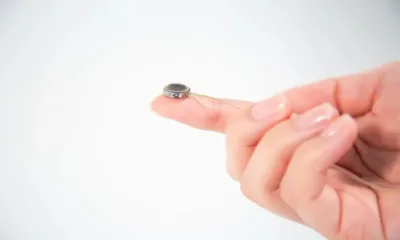 В конкуренция с Neuralink на Мъск: Компанията Paradromics имплантира свой мозъчен чип в човек